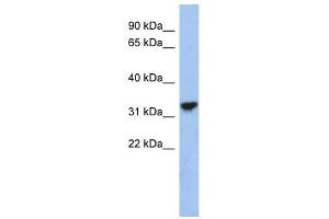 CYC1 antibody used at 1 ug/ml to detect target protein. (Cytochrome C1 抗体  (Middle Region))