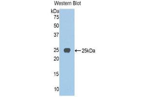 Western Blotting (WB) image for anti-Jagged 1 (JAG1) (AA 836-1047) antibody (ABIN1859518) (JAG1 抗体  (AA 836-1047))