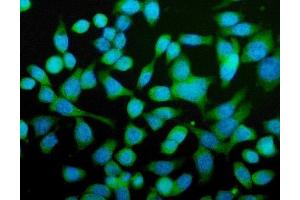 IF analysis of CPN1 using anti-CPN1 antibody (ABIN7600158). (CPN1 抗体  (AA 158-208))