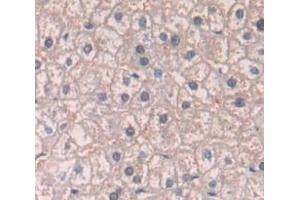 Immunohistochemistry (IHC) image for anti-Patched 1 (PTCH1) (AA 227-436) antibody (ABIN1860347)