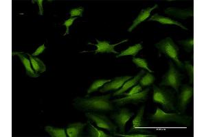 Immunofluorescence of purified MaxPab antibody to SCGN on HeLa cell.