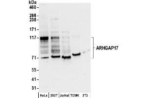 anti-rho GTPase Activating Protein 17 (ARHGAP17) (AA 757-625) antibody