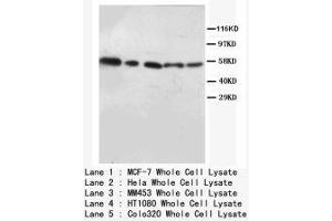 Image no. 2 for anti-V-Akt Murine Thymoma Viral Oncogene Homolog 1/2 (AKT1/2) (N-Term) antibody (ABIN1494209) (AKT1/2 抗体  (N-Term))