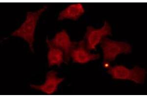 ABIN6274257 staining Hela by IF/ICC. (GRK6 抗体  (N-Term))