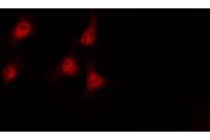 Immunofluorescence (fixed cells) (IF/ICC) image for anti-Sp1 Transcription Factor (SP1) (pThr739) antibody (ABIN6255733)
