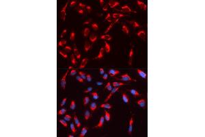 Immunofluorescence analysis of U2OS cell using WASL antibody. (Neural Wiskott-Aldrich syndrome protein (WASL) (AA 1-250) 抗体)