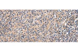 Immunohistochemistry of paraffin-embedded Human tonsil tissue using UBTD1 Polyclonal Antibody at dilution of 1:25(x200) (UBTD1 抗体)