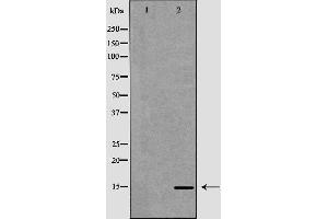 Western blot analysis of extracts of Caco-2 lysate, using CCL21 antibody. (CCL21 抗体  (C-Term))