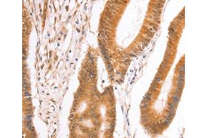 Immunohistochemistry (IHC) image for anti-Tax1 (Human T-Cell Leukemia Virus Type I) Binding Protein 1 (TAX1BP1) antibody (ABIN2428864) (TAX1BP1 抗体)