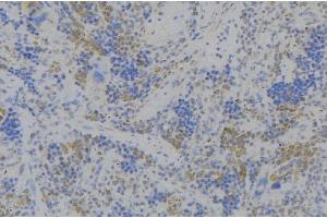 ABIN6279701 at 1/100 staining Human lymph node tissue by IHC-P. (CD164 抗体  (Internal Region))