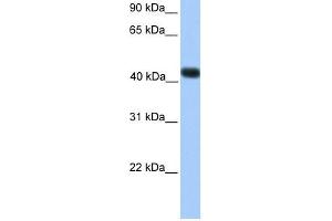 WB Suggested Anti-SSBP4 Antibody Titration:  0. (SSBP4 抗体  (C-Term))
