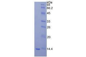 SDS-PAGE analysis of Mouse beta 2-Microglobulin Protein. (beta-2 Microglobulin 蛋白)
