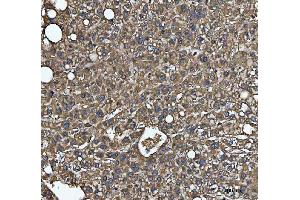 IHC analysis of MTHFD1 using anti-MTHFD1 antibody (ABIN7600631).