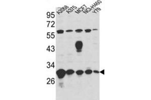 Western Blotting (WB) image for anti-Endoplasmic Reticulum Protein 29 (ERP29) antibody (ABIN3001703) (ERP29 抗体)