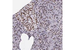 Immunohistochemical staining of human pancreas with GPKOW polyclonal antibody  shows strong nuclear positivity in exocrine glandular cells and islet cells at 1:50-1:200 dilution. (GPKOW 抗体)