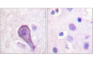 Immunohistochemistry analysis of paraffin-embedded human brain tissue, using Rhodopsin (Ab-334) Antibody. (Rhodopsin 抗体  (AA 299-348))