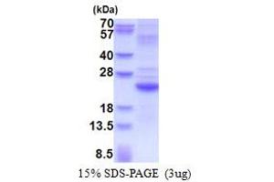 SDS-PAGE (SDS) image for Interleukin 28A (Interferon, lambda 2) (IL28A) (AA 26-200) protein (His tag) (ABIN5853550) (IL28A Protein (AA 26-200) (His tag))