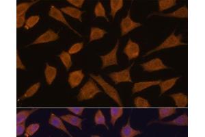 Immunofluorescence analysis of L929 cells using SEPT3 Polyclonal Antibody at dilution of 1:100. (Septin 3 抗体)