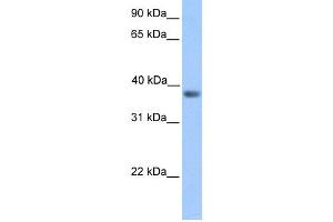 WB Suggested Anti-NEUROD6 Antibody Titration:  0. (NEUROD6 抗体  (Middle Region))