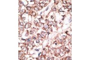 Image no. 3 for anti-Dickkopf 2 Homolog (DKK2) (N-Term) antibody (ABIN357069) (DKK2 抗体  (N-Term))