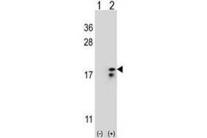 Western blot analysis of COX6A1 (arrow) using rabbit polyclonal COX6A1 Antibody (Center) . (Complex IV Subunit VIaL (AA 57-86), (Middle Region) 抗体)
