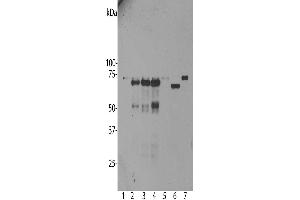 Western blot analysis of untransfected primary mouse neuron and glia cell cultures (lane 1), the same cells transduced with human ubiquilin 2 wild type (lane 2), with ubiquilin 2 P506T mutant (lane 3), with ubiquilin 2 P497S mutant (lane 4) and with enhanced GFP control (lane 5), all probed with ABIN1580461. (Ubiquilin 2 抗体)