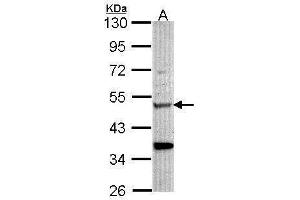WB Image Sample (30 ug of whole cell lysate) A: Hela 10% SDS PAGE antibody diluted at 1:1000 (Chitotriosidase 1 抗体)