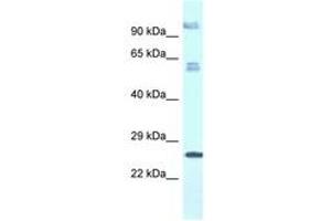 Image no. 1 for anti-Transmembrane Protein 222 (TMEM222) (AA 106-155) antibody (ABIN6747477) (TMEM222 抗体  (AA 106-155))
