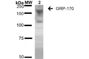 Western Blot analysis of Human Embryonic kidney epithelial cell line (HEK293) lysates showing detection of ~170 kDa GRP170 protein using Mouse Anti-GRP170 Monoclonal Antibody, Clone 6E3-2C2 (ABIN2868628). (HYOU1 抗体)