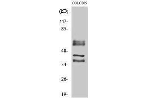 Western Blotting (WB) image for anti-Periphilin 1 (PPHLN1) (Internal Region) antibody (ABIN3186395) (PPHLN1 抗体  (Internal Region))