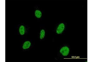 Immunofluorescence of monoclonal antibody to SIX2 on HeLa cell. (SIX2 抗体  (AA 1-291))