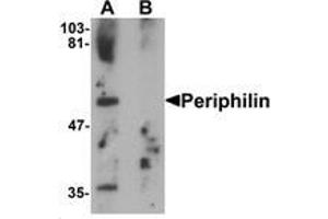 Western blot analysis of Periphilin in mouse colon tissue lysate with Periphilin Antibody   at 1 ug/mL in (A) the absence and (B) the presence of blocking peptide. (PPHLN1 抗体  (Middle Region))