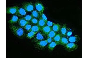 IF analysis of OXCT1/SCOT using anti-OXCT1/SCOT antibody (ABIN7601419).