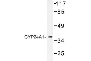 Image no. 1 for anti-Cytochrome P450, Family 24, Subfamily A, Polypeptide 1 (CYP24A1) antibody (ABIN272271) (CYP24A1 抗体)