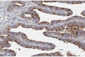 ABIN6266939 at 1/100 staining human Fallopian tube tissue sections by IHC-P. (DLEC1 抗体  (N-Term))
