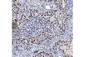 IHC analysis of HDAC2 using anti-HDAC2 antibody (ABIN7601564). (HDAC2 抗体  (AA 387-488))