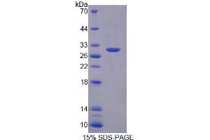 SDS-PAGE (SDS) image for Calcium Channel, Voltage-Dependent, L Type, alpha 1S Subunit (CACNA1S) protein (ABIN6119575)