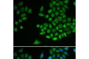 Immunofluorescence analysis of MCF-7 cells using PTPN2 Polyclonal Antibody (PTPN2 抗体)