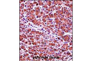 CELA3B Antibody (N-term) (ABIN657692 and ABIN2846683) immunohistochemistry analysis in formalin fixed and paraffin embedded human pancreas tissue followed by peroxidase conjugation of the secondary antibody and DAB staining. (Elastase 3B 抗体  (N-Term))
