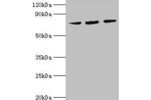 Western blot All lanes: HSPA6 antibody at 2 μg/mL Lane 1: MCF-7 whole cell lysate Lane 2: A431 whole cell lysate Lane 3: Jurkat whole cell lysate Secondary Goat polyclonal to rabbit IgG at 1/10000 dilution Predicted band size: 72 kDa Observed band size: 72 kDa (HSPA6 抗体  (AA 1-637))