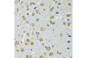Immunohistochemistry (Paraffin-embedded Sections) (IHC (p)) image for anti-Ribonuclease L (2',5'-Oligoisoadenylate Synthetase-Dependent) (RNASEL) (AA 472-741) antibody (ABIN6146994)