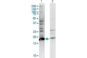 Western Blot analysis of BTF3L4 expression in transfected 293T cell line by BTF3L4 monoclonal antibody (M05), clone 2G10. (BTF3L4 抗体  (AA 1-158))