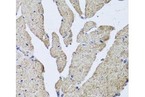 Immunohistochemistry of paraffin-embedded Mouse heart using HBA2 Polyclonal Antibody at dilution of 1:100 (40x lens). (HBa2 抗体)
