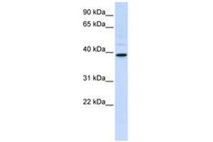 Image no. 1 for anti-Chitinase, Acidic (CHIA) (AA 108-157) antibody (ABIN6740778) (CHIA 抗体  (AA 108-157))