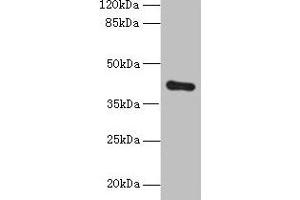 Western blot All lanes: ZDHHC4 antibody at 1. (ZDHHC4 抗体  (AA 277-344))