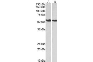 ABIN184685 (0. (Annexin A11 抗体  (N-Term))