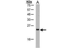 WB Image Sample(30 μg of whole cell lysate) A:H1299 15% SDS PAGE antibody diluted at 1:1000 (ARL2 抗体  (C-Term))