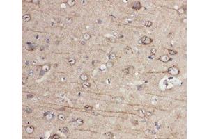 IHC-P: EphA1 antibody testing of rat brain tissue (EPHA1 抗体  (C-Term))