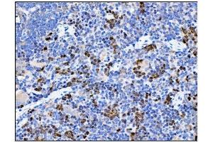 IHC analysis of MGEA5/OGA using anti-MGEA5/OGA antibody (ABIN7602902).