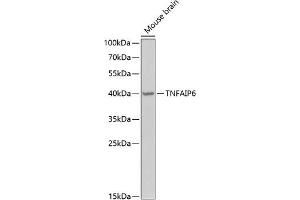 Western blot analysis of extracts of mouse brain, using TNF Antibody (ABIN6130740, ABIN6149294, ABIN6149295 and ABIN6222057) at 1:1000 dilution. (TNFAIP6 抗体  (AA 18-277))
